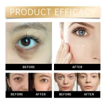 Eelhope Luminous Eye Corrector