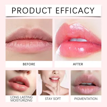Eelhope Lip Lightening Cream Eelhope Lip Lightening Cream