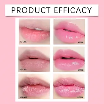 Eelhope Pink Lip Serum Eelhope Pink Lip Serum